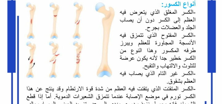 الحوادث التي تصيب العضلات والعظام والمفاصل